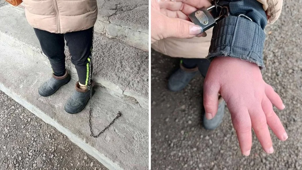 Підозра на жорстоке поводження з дитиною в Кіровоградській області: вихователька розповідає свою версію подій