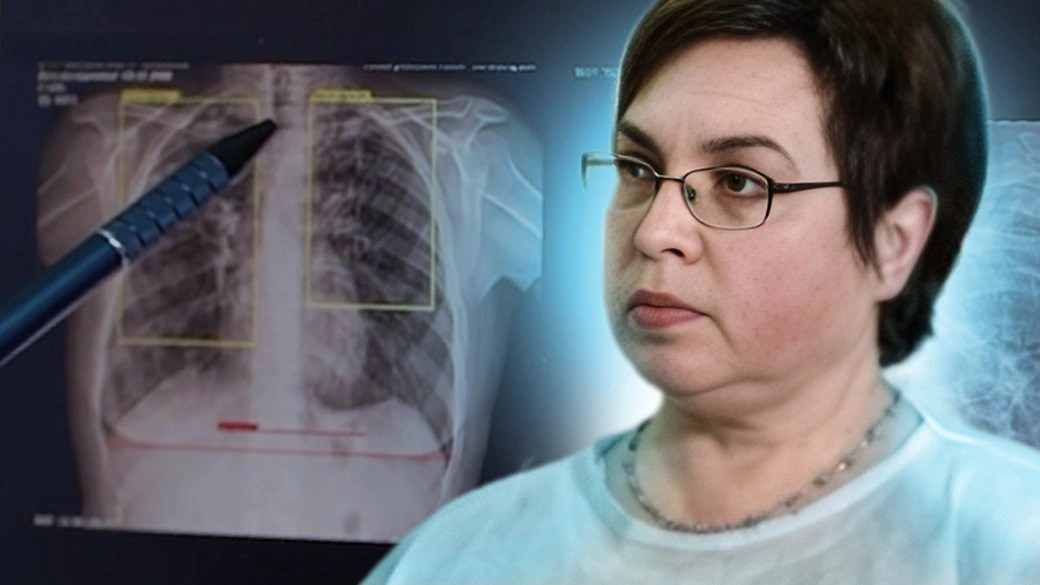 Штучний інтелект та генетичні тести: як на Кіровоградщині змінили підхід до лікування туберкульозу